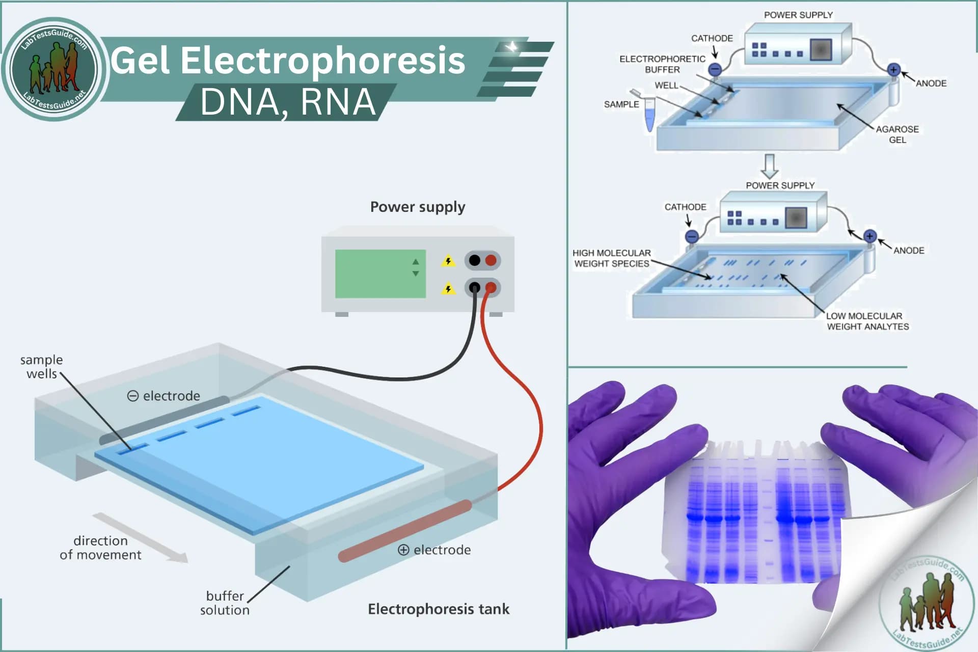 Electrophoresis