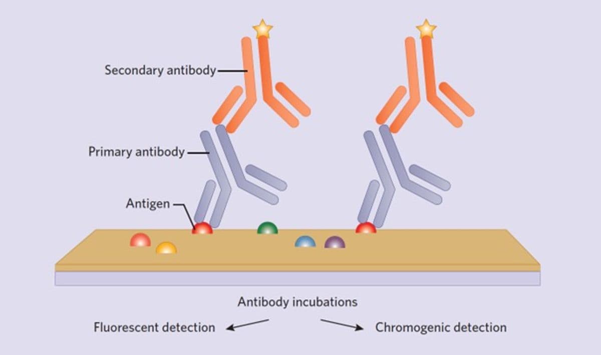 Immunohistochemistry (IHC)