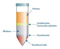 Immune cell isolation