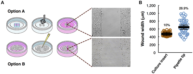In vitro Cell Migration, Invasion, and Adhesion Assays